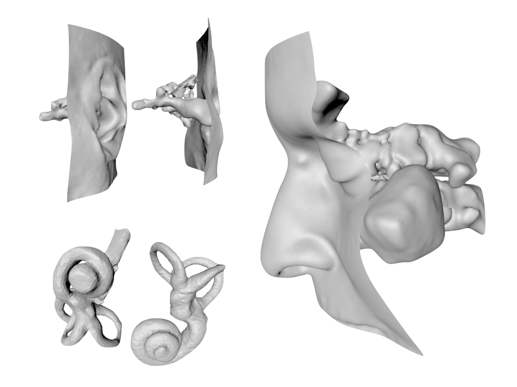 MRI based 3d geometry
